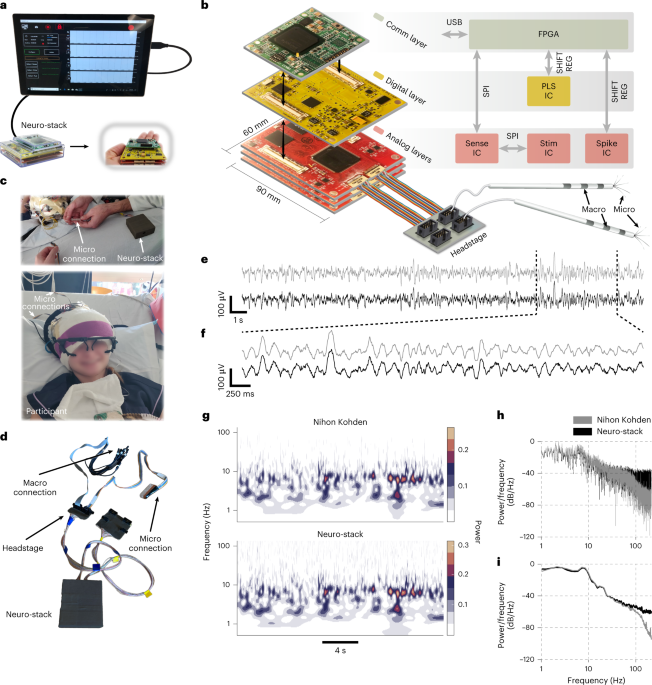 A wearable platform for closed-loop stimulation and recording of single-neuron and local field potential activity in freely moving humans